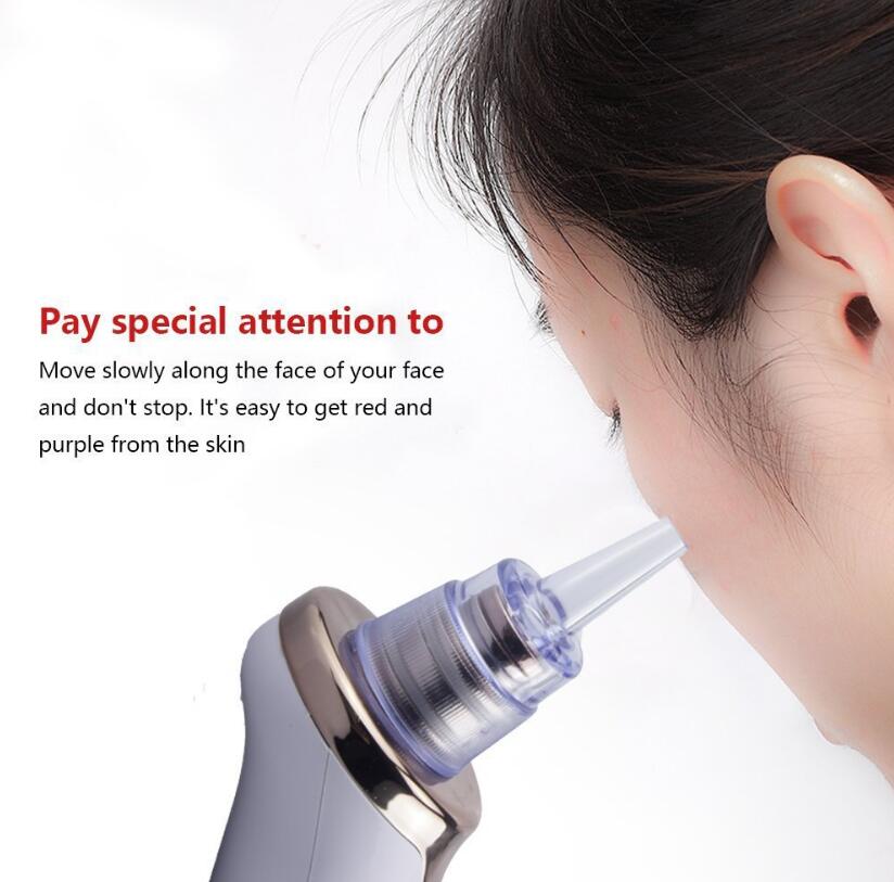 Acne Electric Suction